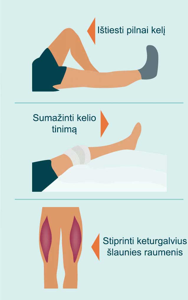 Ankstyvojo reabilitacijos laikotarpio tikslai.